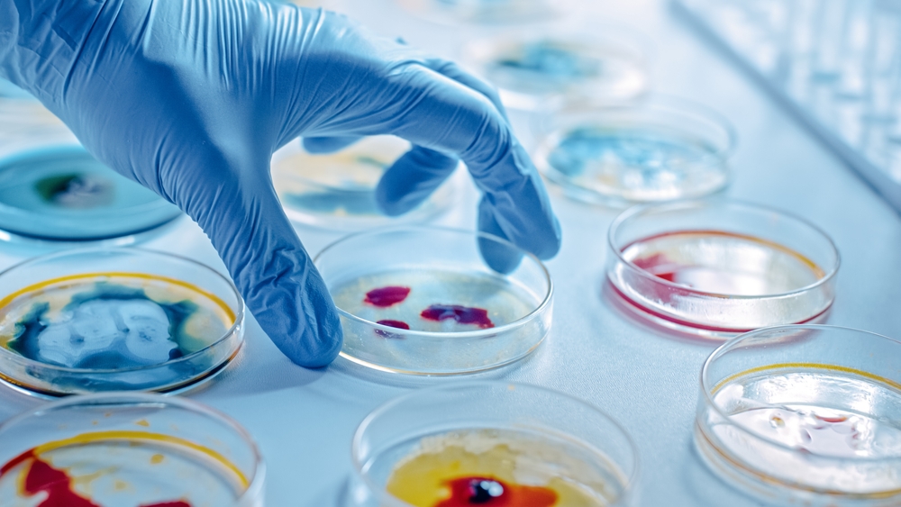 How important is microbiology?