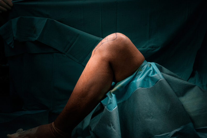 Orthopädischer Chirurg: Alles über die Rolle und Tätigkeiten